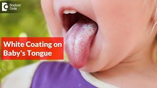 White coating on tongue of baby. Why It Happens and How to Treat It? -Dr. K Saranya Doctors Circle