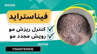 کنترل ریزش مو و رویش مجدد مو با داروی فیناستراید