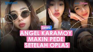 Angel Karamoy Makin Pede Setelah Oplas Hidungnya Kini Ramping Tak Pedulikan Kritikan Netizen