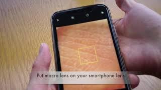 Supereyes Smartphone Macro Lens Attachment