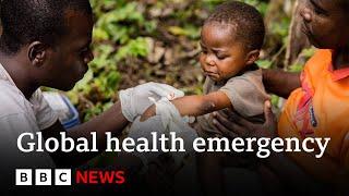 WHO declares mpox outbreak a global health emergency  BBC News