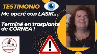 Me operé con LASIK y terminé en trasplante de córnea