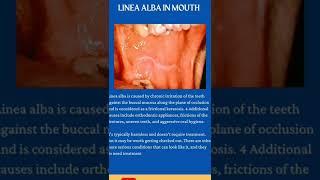 #shorts Linea Alba in Mouth  Patient Education part 3