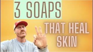The 3 BEST natural SOAPS for Healing ECZEMA PSORIASIS & DERMATITIS