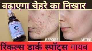 बढ़ाएगा चेहरे का निखार रिंकल्स और डार्क स्पॉट्स से भी मिलेगी राहत Rosden Natural Vitamin C Serum 