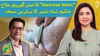 Natural home remedies to treat  Varicose Veins - Hakeem Shah Nazir Remedies - Aaj Pakistan