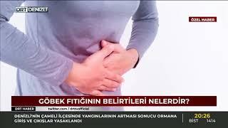 Göbek Fıtığı Umblikal Herni - Op. Dr. Özgür Kaya