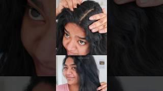 മുടി തഴച്ചു വളരാൻ  #haircare #hairgrowth #hair #dandruff