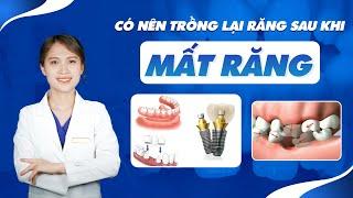 Có Nên Trồng Lại Răng Sau Khi Mất Răng  Nam Bùi Vinalign