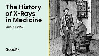 The History of X-Rays in Medicine  Then vs. Now  GoodRx