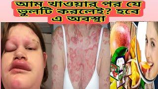 আম খাওয়ার পর যে ৫টি খাবার ভুলেও খাবেন না। পাকা আম খাওয়ার পর এই ৫ খাবার খেলেই জীবন শেষ।