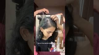 Derma rolling for hair growth 