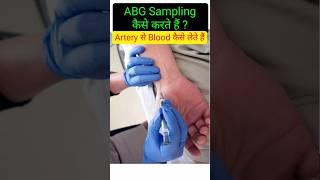 ABG Sample कैसे लेते हैं ? Artery से Blood कैसे लेते हैं ? How to take ABG Sampling from Artery