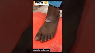 Get Fair Feet PermanentlyDirtTanning Remove Homeremedy ll #darknessremove#skincare#viral#ytshorts