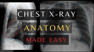 How to Read Chest X-ray Anatomy  Learn Basic Chest Anatomy fast. #chestxray  #anatomy
