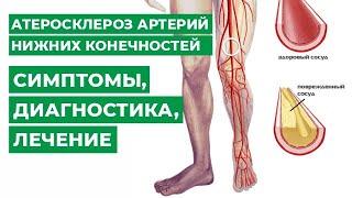 Атеросклероз артерий нижних конечностей симптомы диагностика лечение.