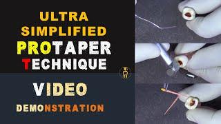 Ultra Simplified Protaper Technique  Video demonstration