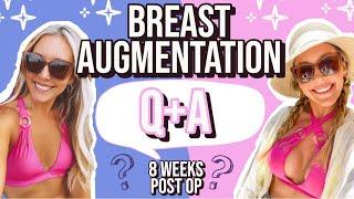 MY BREAST AUGMENTATION EXPERIENCE Q+A @Brianna K