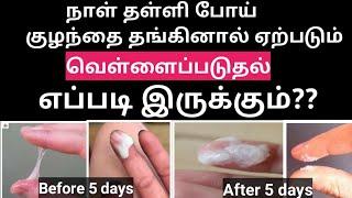 White discharge is sign of pregnancy symptoms in tamil pregnancy symptoms in tamil womans life