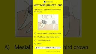 NEET MDS  INI-CET MDS  PSC  BDS - Most Important Questions  #neetmds2025 #mdsprep