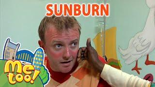 @MeTooOfficialTVShow  ️ Sunburn ️  #FullEpisode  SUMMER  TV Show For Kids