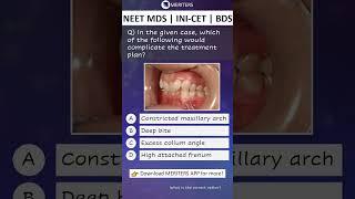 NEET MDS  INI-CET MDS  PSC  BDS - Most Important Questions  #neetmds2025 #mdsprep