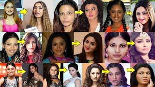 Top 8 TV Actresses Who Looks Horrible After Plastic Surgery  Before And After of Plastic Surgery