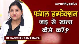 क्या है फंगल इन्फेक्शन?  Dr Kanchan Srivastava on Fungal Infection in Hindi  Causes & Treatment