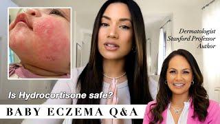 Baby Eczema Q&A treatment & tips from a leading Dermatolgist