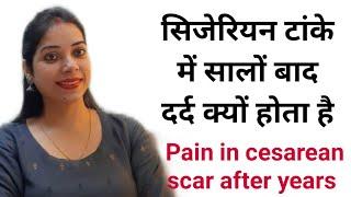 सिजेरियन टांके में सालों बाद दर्द क्यों होता है Pain in cesarean scar after years  IndianMomsNest