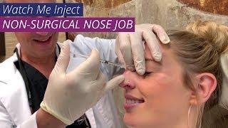 Non Surgical Nose Job  Rhinoplasty Alternative for Young Bride