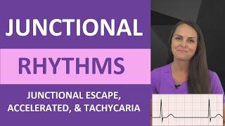 Junctional Rhythms Made Easy EKG Interpretation Nursing NCLEX ECG Review