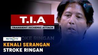 Kenali Serangan Stroke Ringan