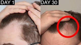 Copenhagen Grooming Hair Growth Results After 30 Days  Copenhagen Grooming Hair Growth Review