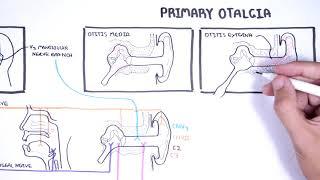 Understanding Ear Pain - Otalgia Innervation of ear mechanism of ear pain and causes