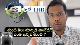 Total hip replacement surgery Cost? Hip pain AVN  YSR Aarogyasri Scheme and Insurnace coverage