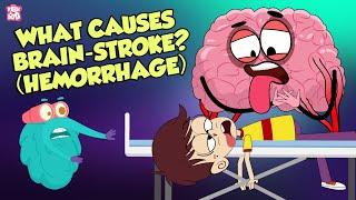 What Causes A Brain Stroke?  Brain Attack  The Dr Binocs Show  Peekaboo Kidz
