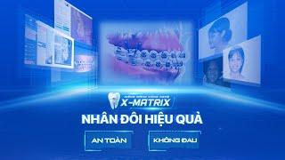  Niềng răng NHÂN ĐÔI hiệu quả nhanh hơn cùng X-Matrix