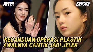 Keseringan Operasi Plastik 5 Artis Korea Awalnya Cantik Jadi Jelek