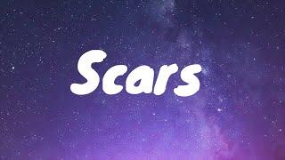 Scars- Novulent Lyrics