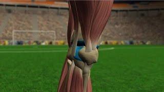 Lesiones de rodilla