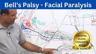 Bell’s Palsy  Facial Paralysis  Neuroscience