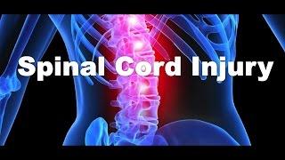 What is a spinal cord injury?