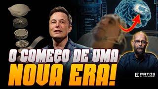 Urgente Elon Musk implanta chip no cérebro do primeiro humano