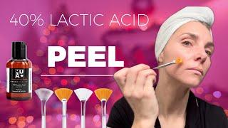 40% LACTIC ACID PEEL  FOR GLOWING HOLIDAY SKIN