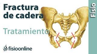 Fracturas de fémur cadera y pelvis - Tratamiento y cuidados para su recuperación