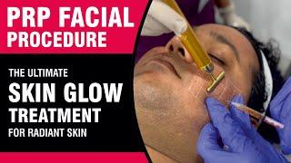 PRP Facial Procedure Video The Ultimate Skin Glow Treatment for Radiant Skin  Sakhiya Skin Clinic