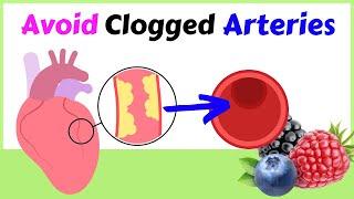 How To Avoid Clogged Arteries 8 Foods To Eat for Healthy Heart