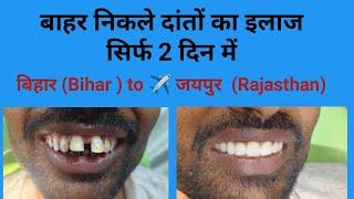 बिहार Bihar जयपुर राजस्थान से आये मरीज़ों का हुआ बाहर निकले दांतों का इलाजSmile design treatment