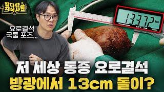 너무 아파서 아프단 말도 안 나온다는 요로결석의 역사